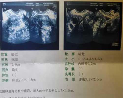 南京生育三胎的补贴 南京做试管多少钱啊？试管婴儿价位是多少？ ‘尿液放酒